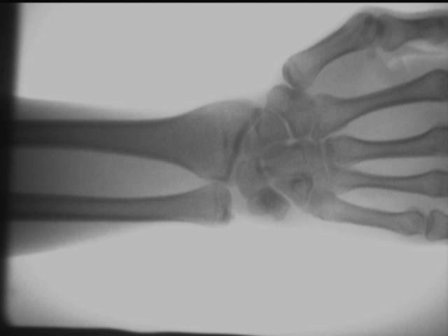 Hand ankle joint effect Hand ankle joint effect